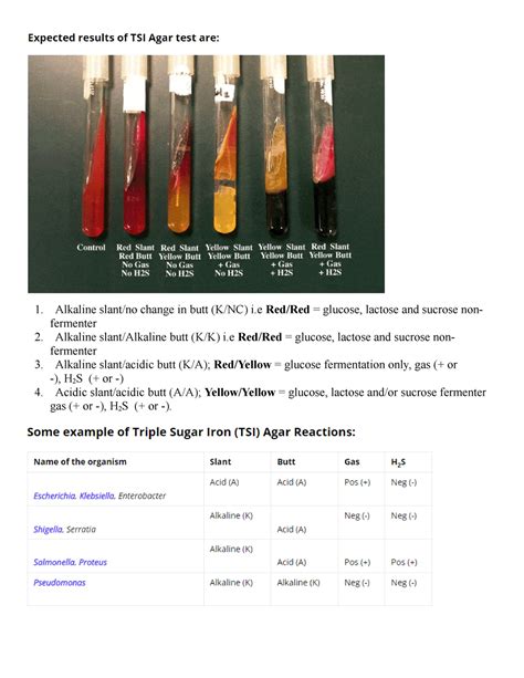 TSI Citrate - durreshehwar department of microbiology - Alkaline slant ...