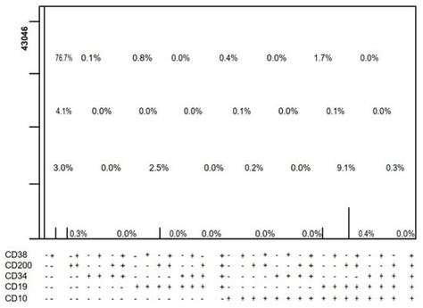 Prognostic Role of CD200 in Acute Lymphoblastic Leukemia Patients