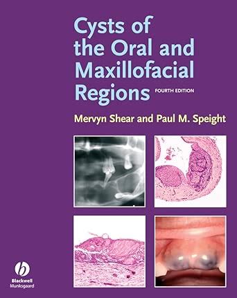 Buy Cysts of the Oral and Maxillofacial Regions Book Online at Low ...