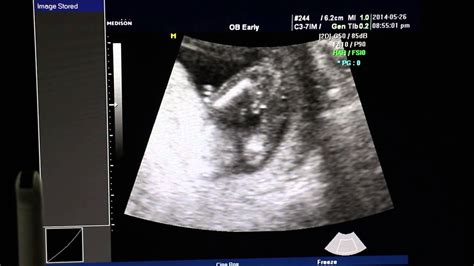 20140526懷孕14周稍微可以判斷出性別 - YouTube