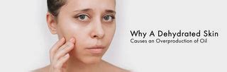 Why Dehydrated Skin Causes an Overproduction of Oil – Kass