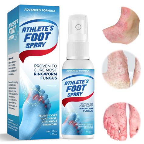 Athletes Foot Treatment Spray Natural Powder Athletes Foot Treatment Foot | Desertcart INDIA