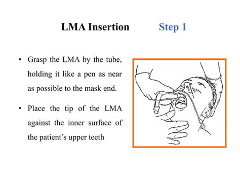 Image result for LMA Machine