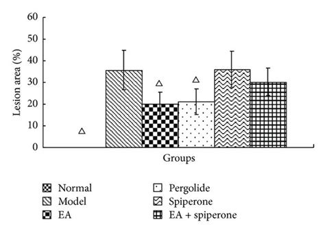 Image result for Contralateral Hemisphere