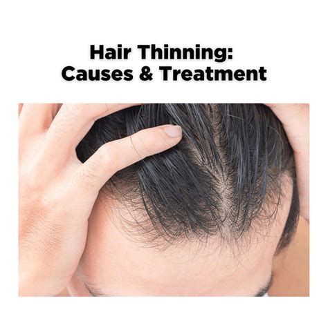 Thinning Hair - Causes and Treatment – SGPomades