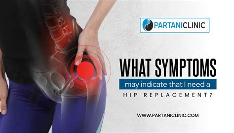 Hip Replacement Symptoms: Indicate that I need a Hip Replacement?