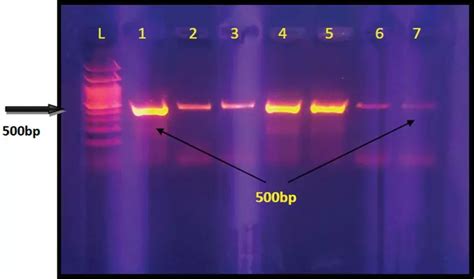 Molecular detection and antimicrobial resistance of Clostridium ...