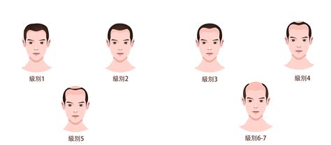 Image result for Raspberry 5 Pi Hailo AI Tutorial