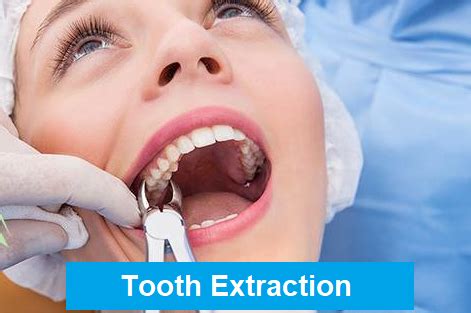 Tooth Extraction Aftercare - Anoka Dental