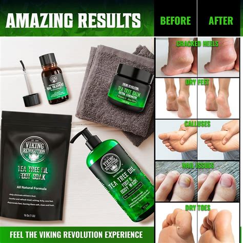 Athlete's Foot Warm Soak