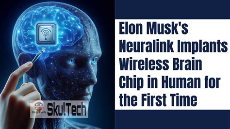 Elon Musk's Neuralink Implants Wireless Brain Chip in Human for the ...