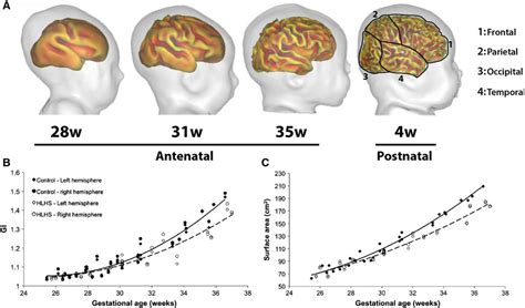 Image result for Heart Abnormal Development