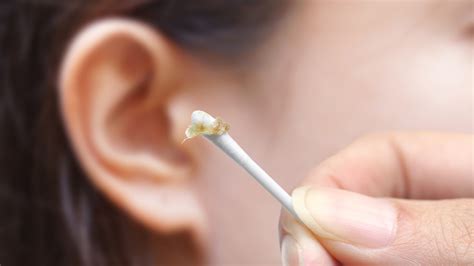 Dry Flaky Skin In Ears Causes