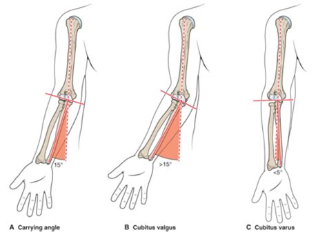 Image result for Elbow Contralateral