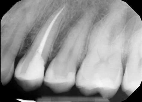 Xray Exposure How Safe Are Xrays Dental x-rays | Studio Dentaire