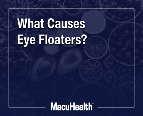 What Are The Different Types Of Eye Floaters at Ruben Grimes blog