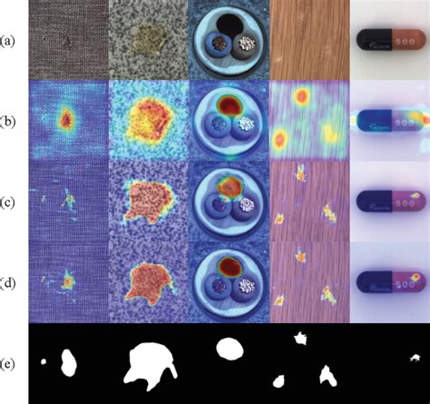 Image result for Deep Learning Anomaly Surface Detection Python