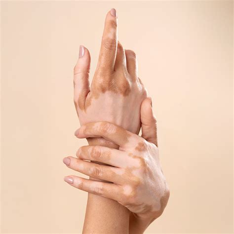 Wizderm Jodhpur Park – Dermatologists & Skin and Hair Clinic