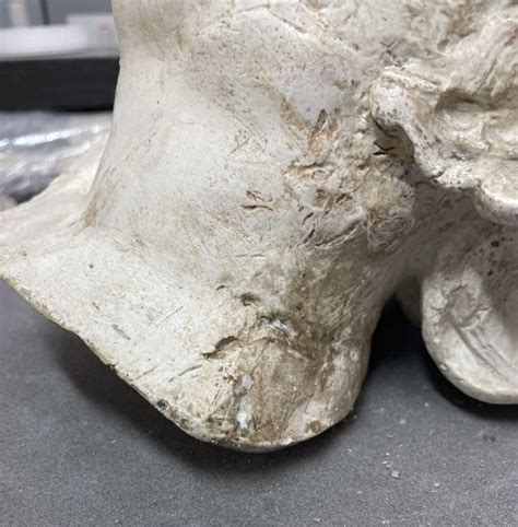 Curing Plaster Cast 的图像结果