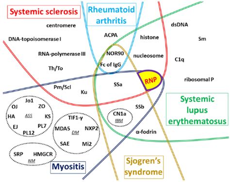 Mixed Connective Tissue Disease (MCTD): 6 Case Based Review
