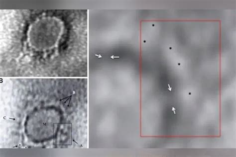 First electron microscope images of Covid-19 virus in India released