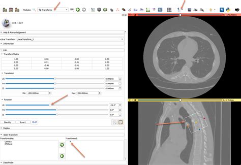 Image result for 3D Slicer Segmentation Tutorial
