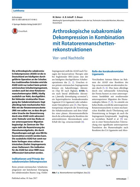 Image result for Subacromial Decompression Rotator Cuff Repair