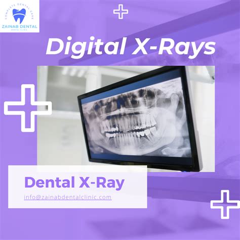 Best X Ray In Karachi