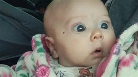 “Mi bebé nació con hermosos ojos azules, pero descubrimos algo terrible”