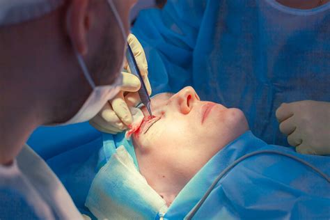 Finding the Best Mohs Surgery for Your Skin Cancer in Sarasota, Florida | Dermatology and Skin ...