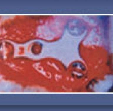 Biomedical Devices For Internal Use | Defence Research and Development ...