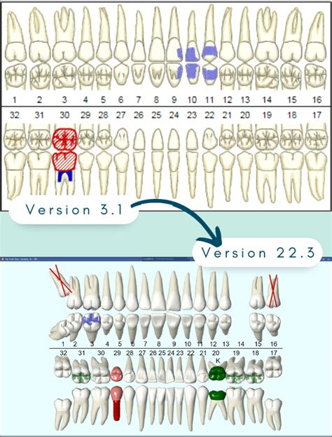 Image result for Open Dental Tutorials