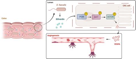 Image result for Enterococcus Faecalis Colon Cancer