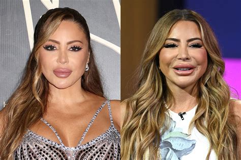 Larsa Pippen Explains Face Changes Before & After PRP injection