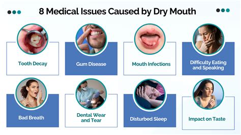 Dry Mouth Dental Issues at Cecila Whitworth blog