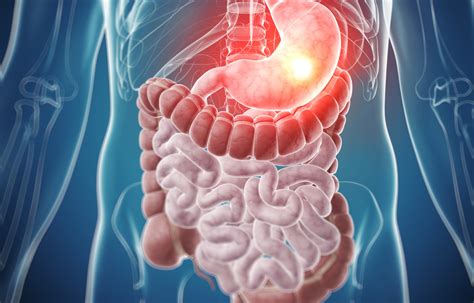 AI reduces miss rate of precancerous polyps in colorectal cancer screening