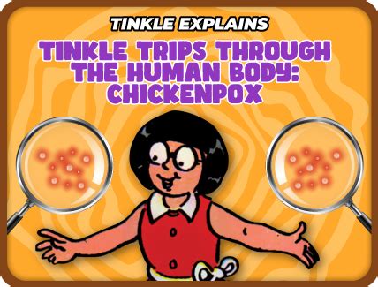 Tinkle Trips Through the Human Body: Chickenpox - Tinkle
