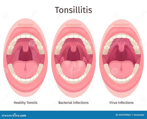 Human Sore Ear In Front. Diseases Ear And Pain. Part Of The Face. Otitis. The Organ Of Hearing ...