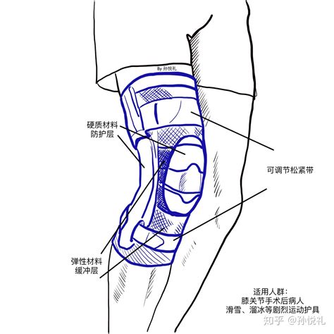 如何科学选用护膝 - 知乎