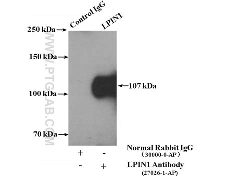 LPIN1 antibody (27026-1-AP) | Proteintech
