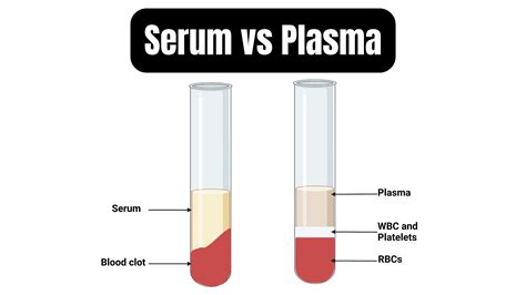 Blood Serum Vs Blood Plasma | Education Suisse
