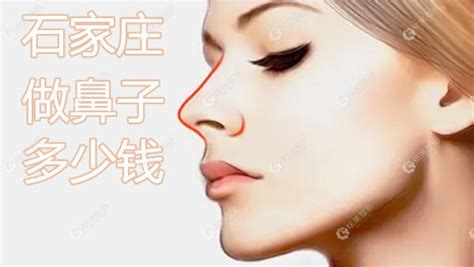 杭州时光哪位医生做鼻子好？黄良飞、项昌峰做隆鼻技术蛮好的 - 隆鼻手术 - 炫美网