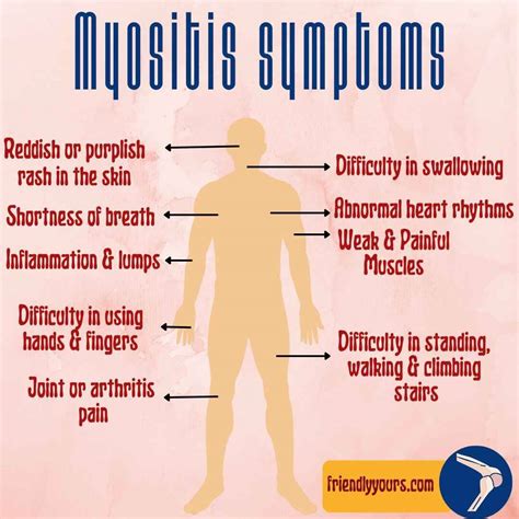 Health & Wellness — Is there any natural treatment for myositis? Know...