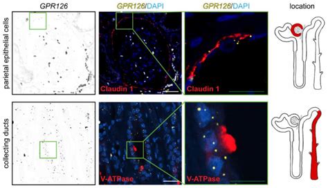 Adhesion GPCR Gpr126 (Adgrg6) Expression Profiling in Zebrafish, Mouse ...