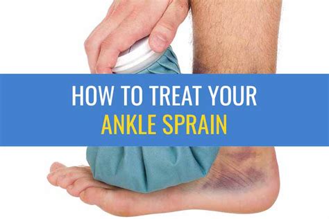 Ankle Sprain Treatment | Sprained Ankle Exercises | Sports Injury Physio