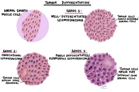 Scale Of Differentiation