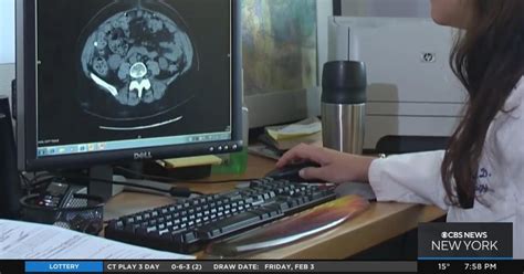 Image result for Removing Fallopian Tubes