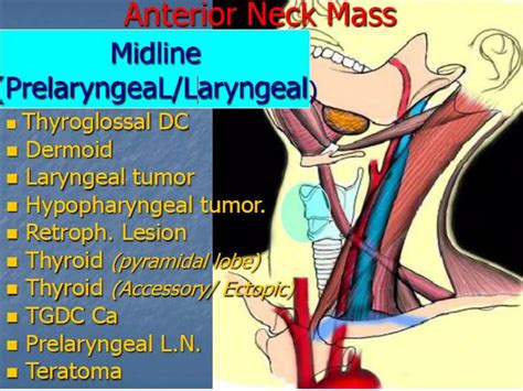 Presentation1.pptx, radiological imaging of adult neck masses. | PPTX