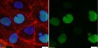 Anti-ECT2 Antibody | 07-1364