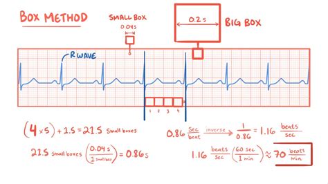 How To Calculate Ekg Heart Rate - GGWE